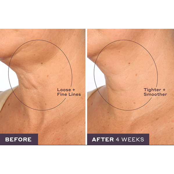 Seyeon Soul™ 2-in-1 Neck and Jawline Sculpting Cream