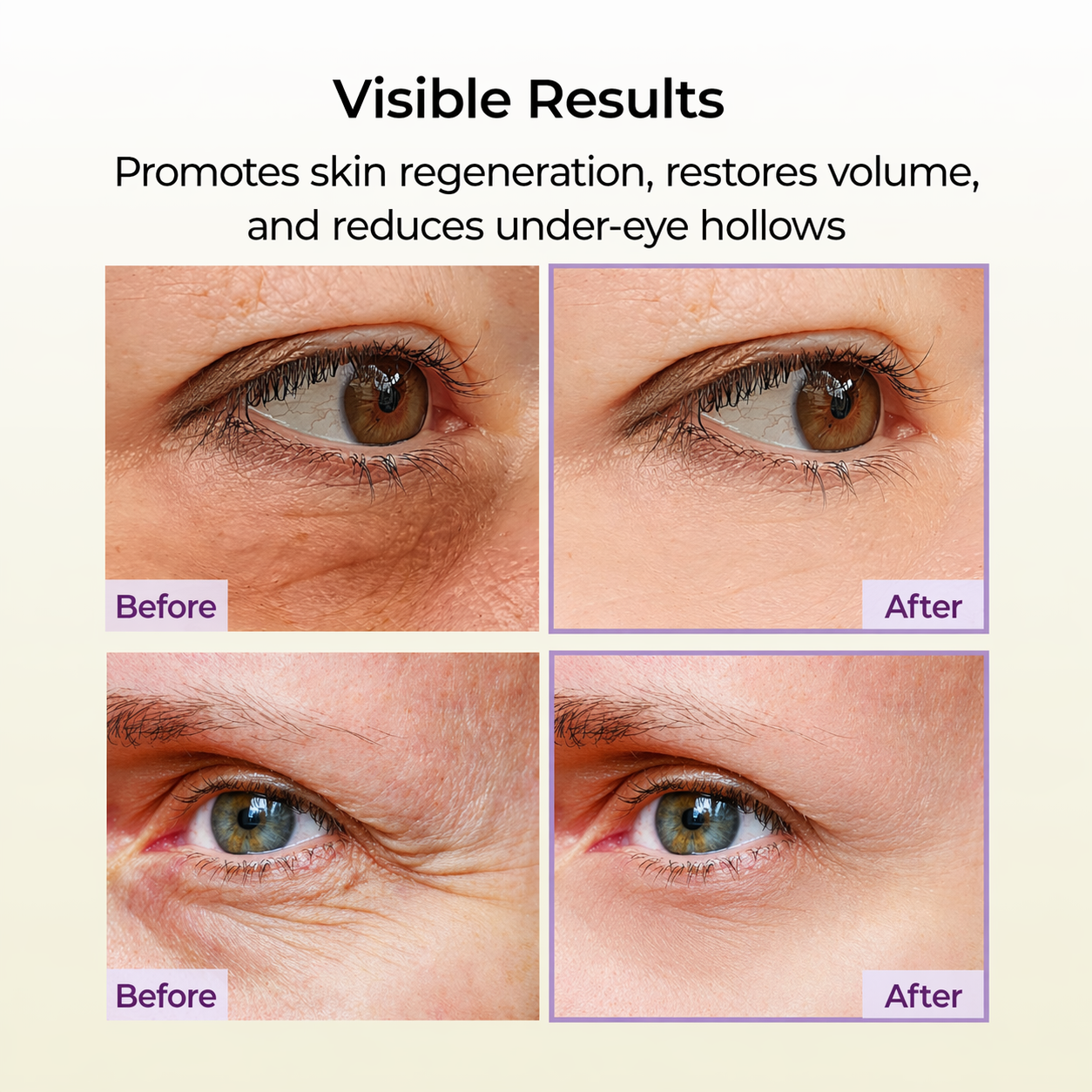 Seyeon Seoul Instant Eye Lift Gel™