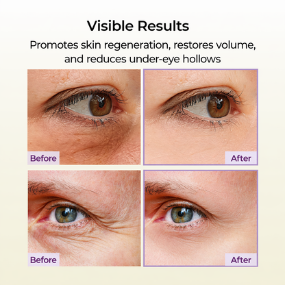 Seyeon Seoul Instant Eye Lift Gel™